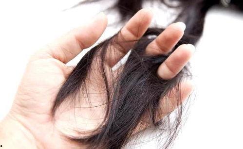 吃瓜小熊脱发,从脱发困扰到秀发重生